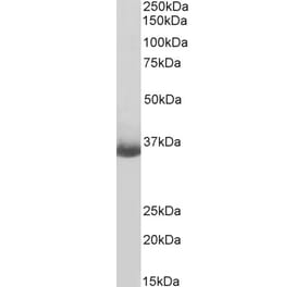Western Blot - Anti-MS4A1 Antibody (A83575) - Antibodies.com