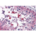 Immunohistochemistry - Anti-ABCD4 Antibody (A83576) - Antibodies.com