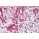 Immunohistochemistry - Anti-ABCD4 Antibody (A83576) - Antibodies.com