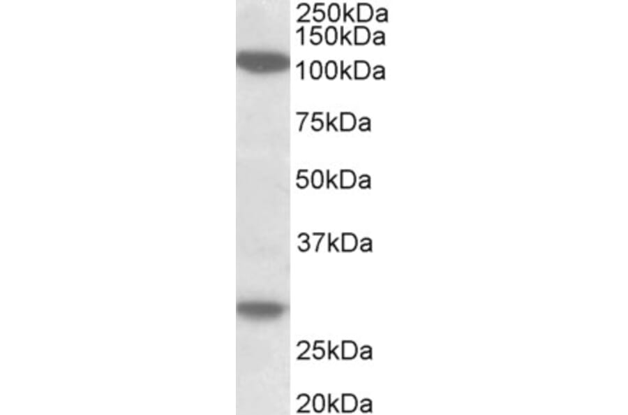 Western Blot - Anti-UBN1 Antibody (A83578) - Antibodies.com