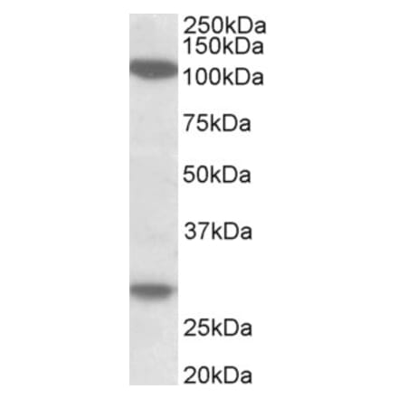 Western Blot - Anti-UBN1 Antibody (A83578) - Antibodies.com