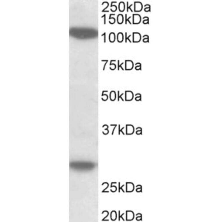Western Blot - Anti-UBN1 Antibody (A83578) - Antibodies.com