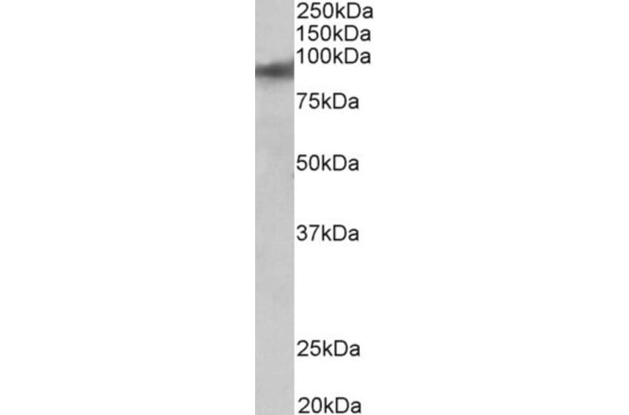 Western Blot - Anti-ZNF652 Antibody (A83581) - Antibodies.com
