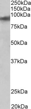 Anti-ZNF652 Antibody (A83581) (0.01µg/ml) staining of Human Heart lysate (35µg protein in RIPA buffer). Primary incubation was 1 hour. Detected by chemiluminescence.