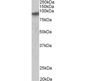 Western Blot - Anti-ZNF652 Antibody (A83581) - Antibodies.com