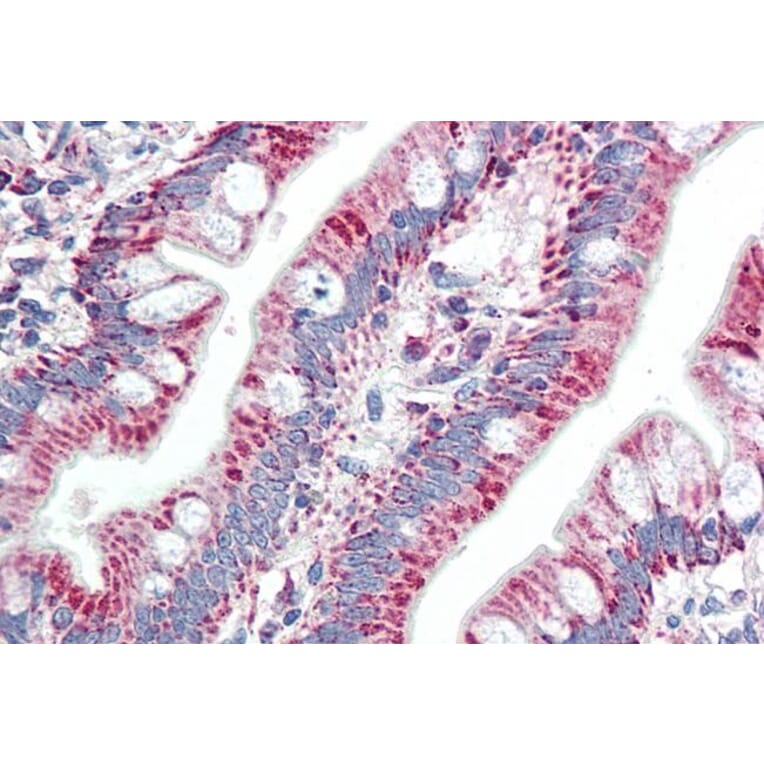 Immunohistochemistry - Anti-ZNF652 Antibody (A83581) - Antibodies.com