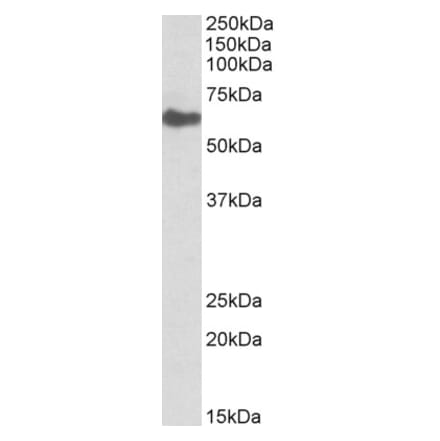 Western Blot - Anti-GGT1 Antibody (A83583) - Antibodies.com