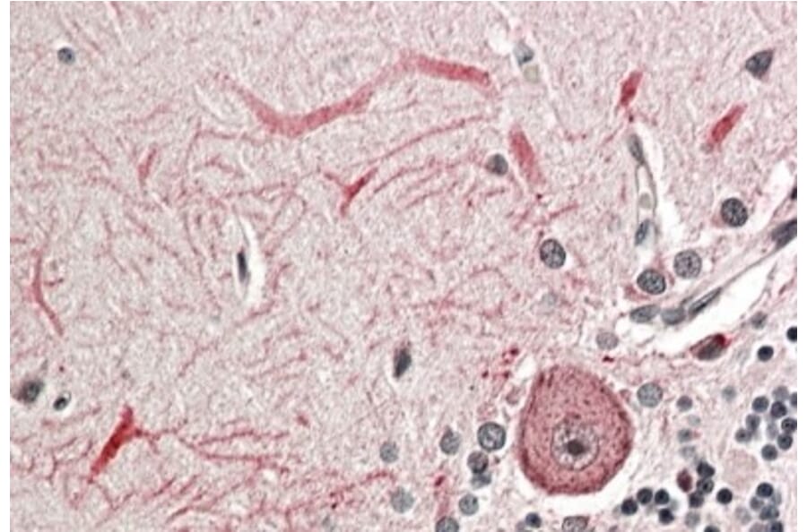 Immunohistochemistry - Anti-Keap1 Antibody (A83585) - Antibodies.com