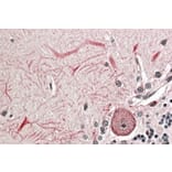 Immunohistochemistry - Anti-Keap1 Antibody (A83585) - Antibodies.com