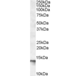 Western Blot - Anti-C1D Antibody (A83589) - Antibodies.com