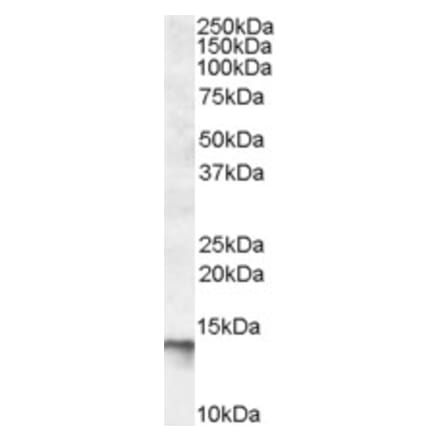 Western Blot - Anti-C1D Antibody (A83589) - Antibodies.com