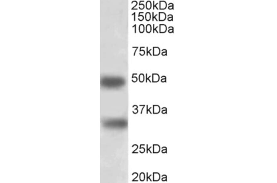 Western Blot - Anti-GEM Antibody (A83593) - Antibodies.com