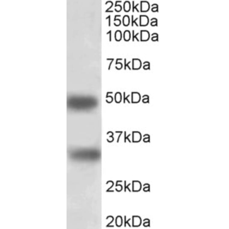 Western Blot - Anti-GEM Antibody (A83593) - Antibodies.com
