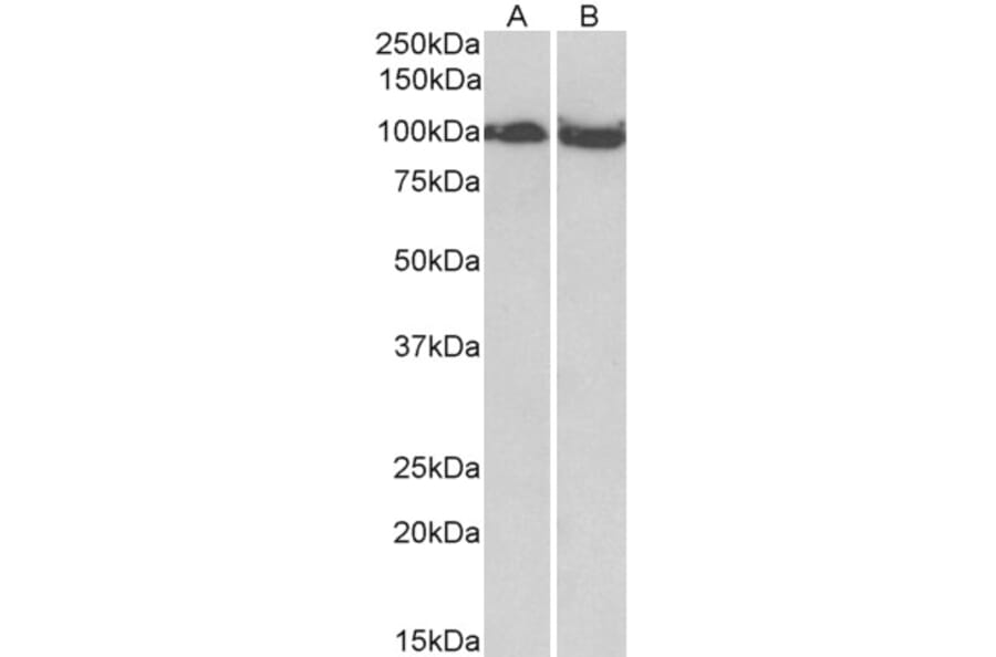 Western Blot - Anti-KAT13D/CLOCK Antibody (A83594) - Antibodies.com