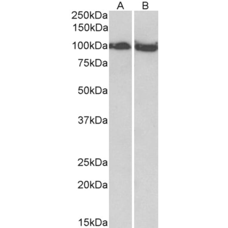 Western Blot - Anti-KAT13D/CLOCK Antibody (A83594) - Antibodies.com