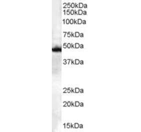 Western Blot - Anti-CSK Antibody (A83596)