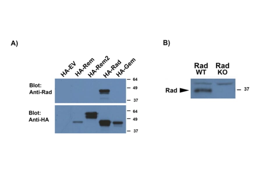 Western Blot - Anti-RRAD Antibody (A83598) - Antibodies.com
