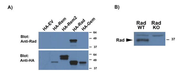 A): Anti-RRAD Antibody (A83598) (0.5µg/ml) staining of HEK293 lysates overexpressing several HA-tagged Mouse GTPases, including Rrad (10µg protein in RIPA buffer) and compared with an HA-specific antibody. B): Anti-RRAD Antibody (A83598) (0.5µg/ml) staining of WT and KO lysates of Mouse Heart (100µg protein in RIPA buffer). Primary incubation was 1 hour. Detected by chemiluminescence.
