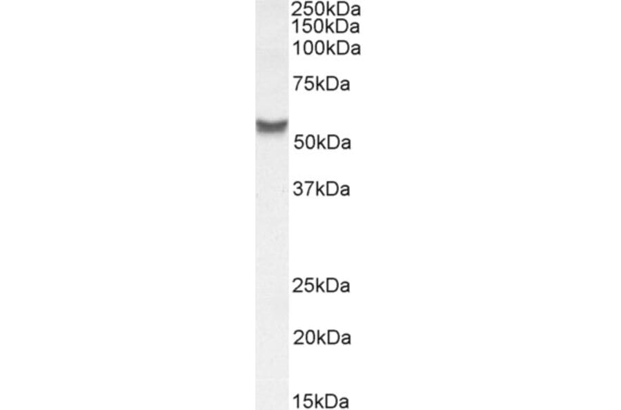 Western Blot - Anti-SLC7A6 Antibody (A83599) - Antibodies.com