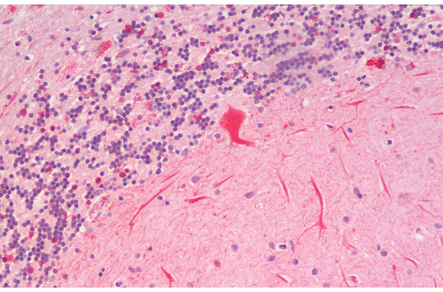 Immunohistochemistry - Anti-SLC7A6 Antibody (A83599) - Antibodies.com