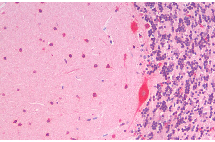 Immunohistochemistry - Anti-SLC7A6 Antibody (A83600) - Antibodies.com
