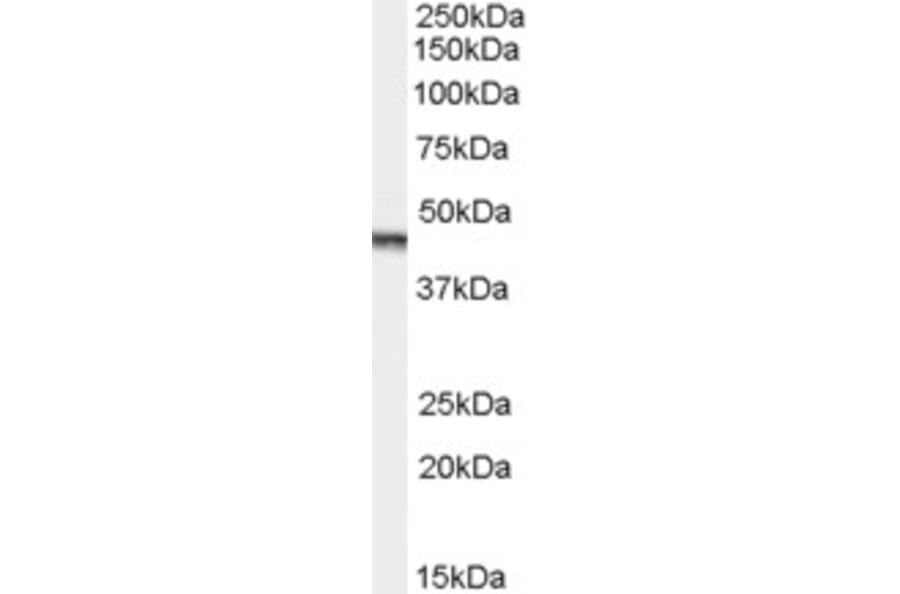 Western Blot - Anti-Aurora A Antibody (A83601) - Antibodies.com
