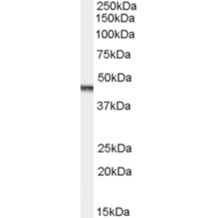 Western Blot - Anti-Aurora A Antibody (A83601) - Antibodies.com