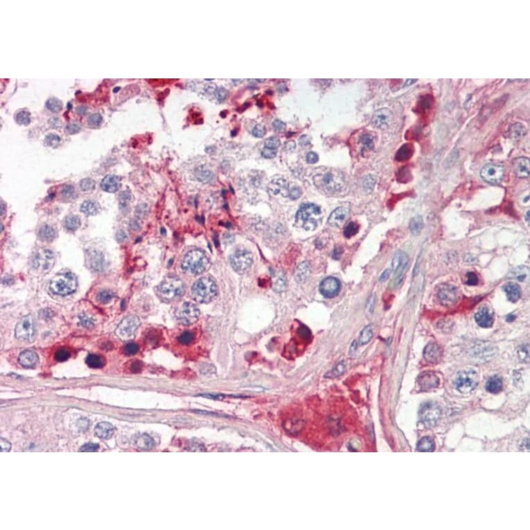 Immunohistochemistry - Anti-CRISP2 Antibody (A83603) - Antibodies.com