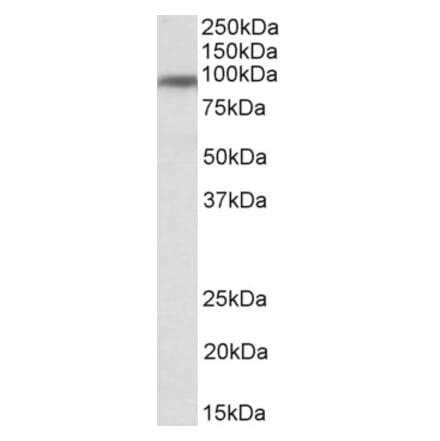 Western Blot - Anti-Transferrin Receptor Antibody (A83605) - Antibodies.com