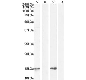 Western Blot - Anti-Parvalbumin Antibody (A83606) - Antibodies.com