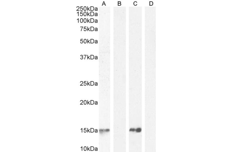 Western Blot - Anti-Parvalbumin Antibody (A83606) - Antibodies.com