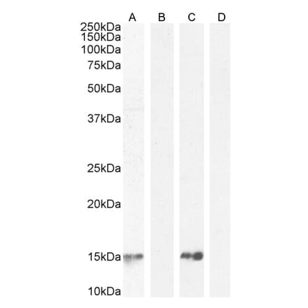 Western Blot - Anti-Parvalbumin Antibody (A83606) - Antibodies.com