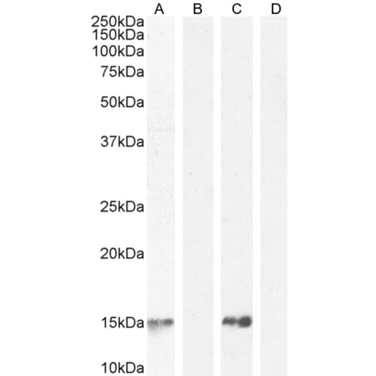 Western Blot - Anti-Parvalbumin Antibody (A83606) - Antibodies.com