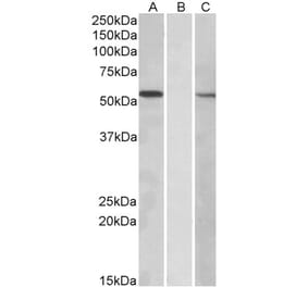 Western Blot - Anti-MGAT1 Antibody (A83608) - Antibodies.com