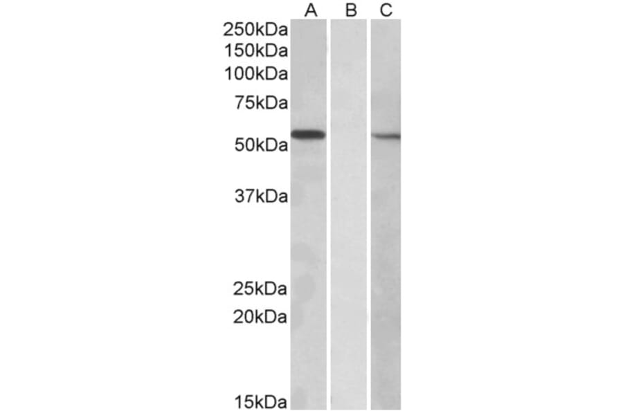 Western Blot - Anti-MGAT1 Antibody (A83608) - Antibodies.com