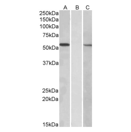 Western Blot - Anti-MGAT1 Antibody (A83608) - Antibodies.com