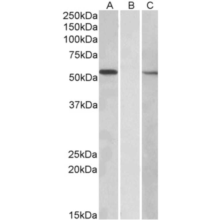 Western Blot - Anti-MGAT1 Antibody (A83608) - Antibodies.com