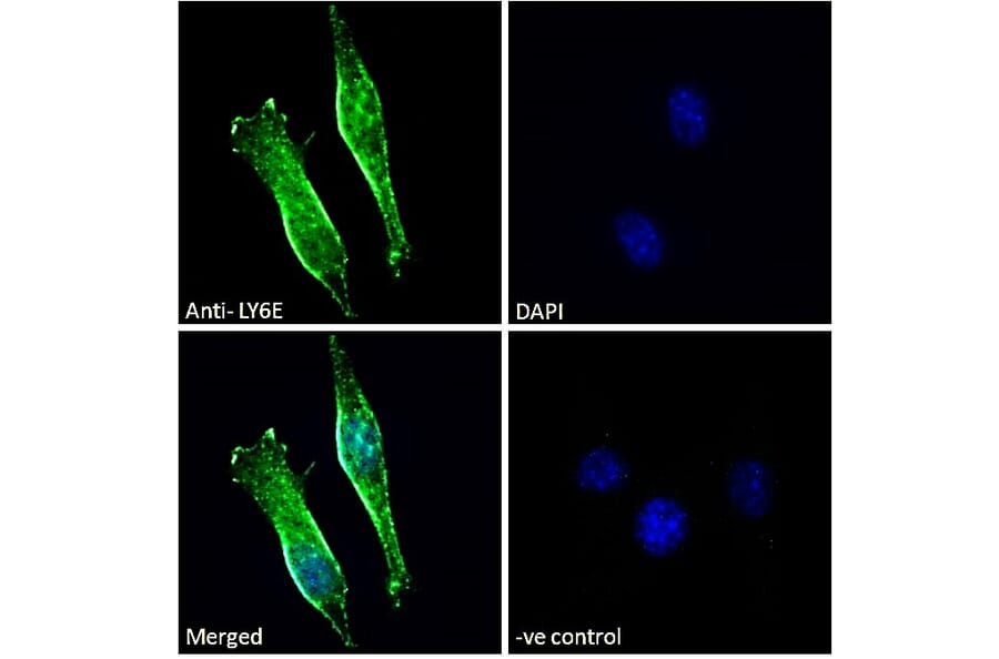 Immunofluorescence - Anti-LY6E/SCA-2 Antibody (A83609) - Antibodies.com