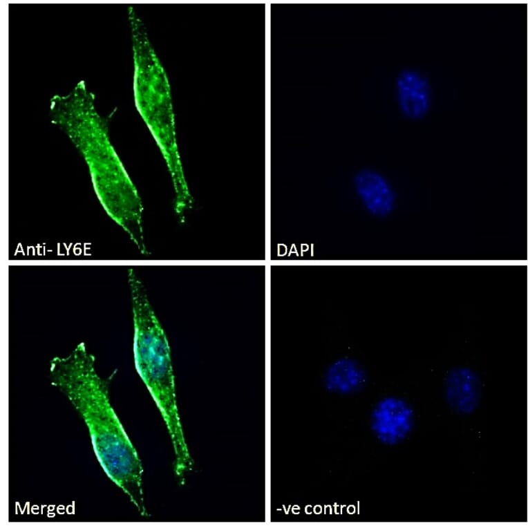 Immunofluorescence - Anti-LY6E/SCA-2 Antibody (A83609) - Antibodies.com