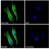 Immunofluorescence - Anti-LY6E/SCA-2 Antibody (A83609) - Antibodies.com