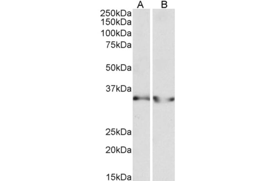 Western Blot - Anti-Lactate Dehydrogenase B/LDH-B Antibody (A83610) - Antibodies.com