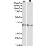 Western Blot - Anti-Lactate Dehydrogenase B/LDH-B Antibody (A83610) - Antibodies.com