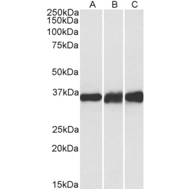 Western Blot - Anti-Lactate Dehydrogenase B/LDH-B Antibody (A83611) - Antibodies.com