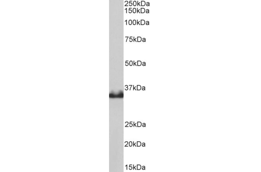 Western Blot - Anti-Lactate Dehydrogenase B/LDH-B Antibody (A83611) - Antibodies.com