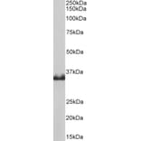 Western Blot - Anti-Lactate Dehydrogenase B/LDH-B Antibody (A83611) - Antibodies.com