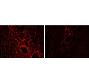 Immunohistochemistry - Anti-HO-2 Antibody (A83612) - Antibodies.com