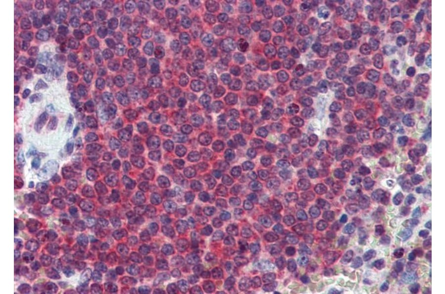 Immunohistochemistry - Anti-Carbonic Anhydrase 1/CA1 Antibody (A83615) - Antibodies.com