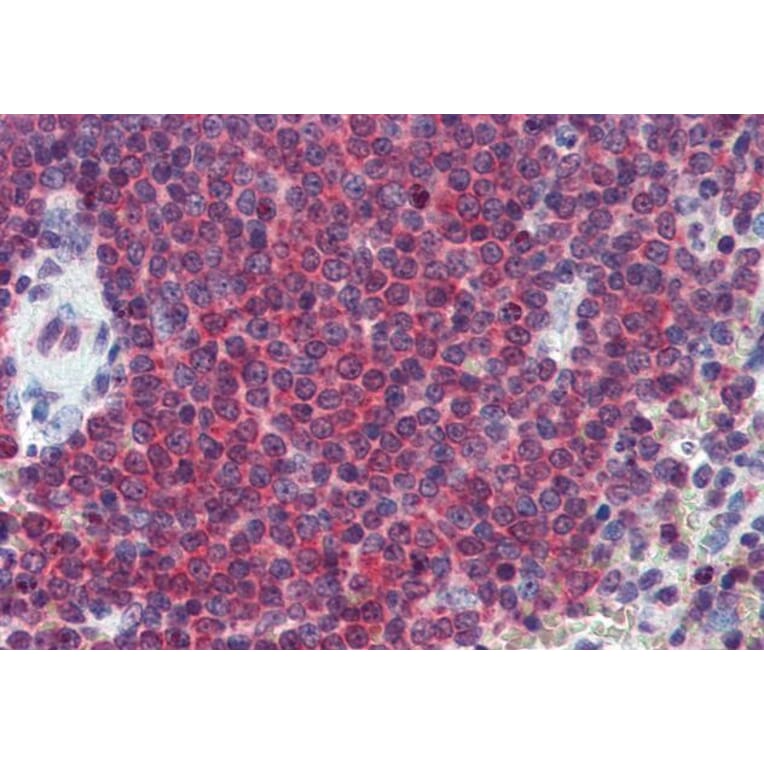 Immunohistochemistry - Anti-Carbonic Anhydrase 1/CA1 Antibody (A83615) - Antibodies.com