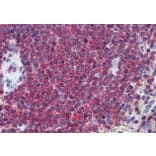 Immunohistochemistry - Anti-Carbonic Anhydrase 1/CA1 Antibody (A83615) - Antibodies.com