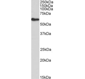 Western Blot - Anti-FRS2 Antibody (A83617) - Antibodies.com